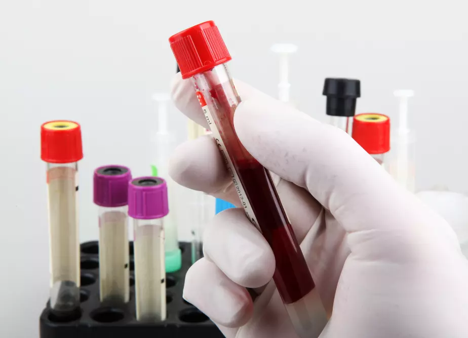química sanguínea